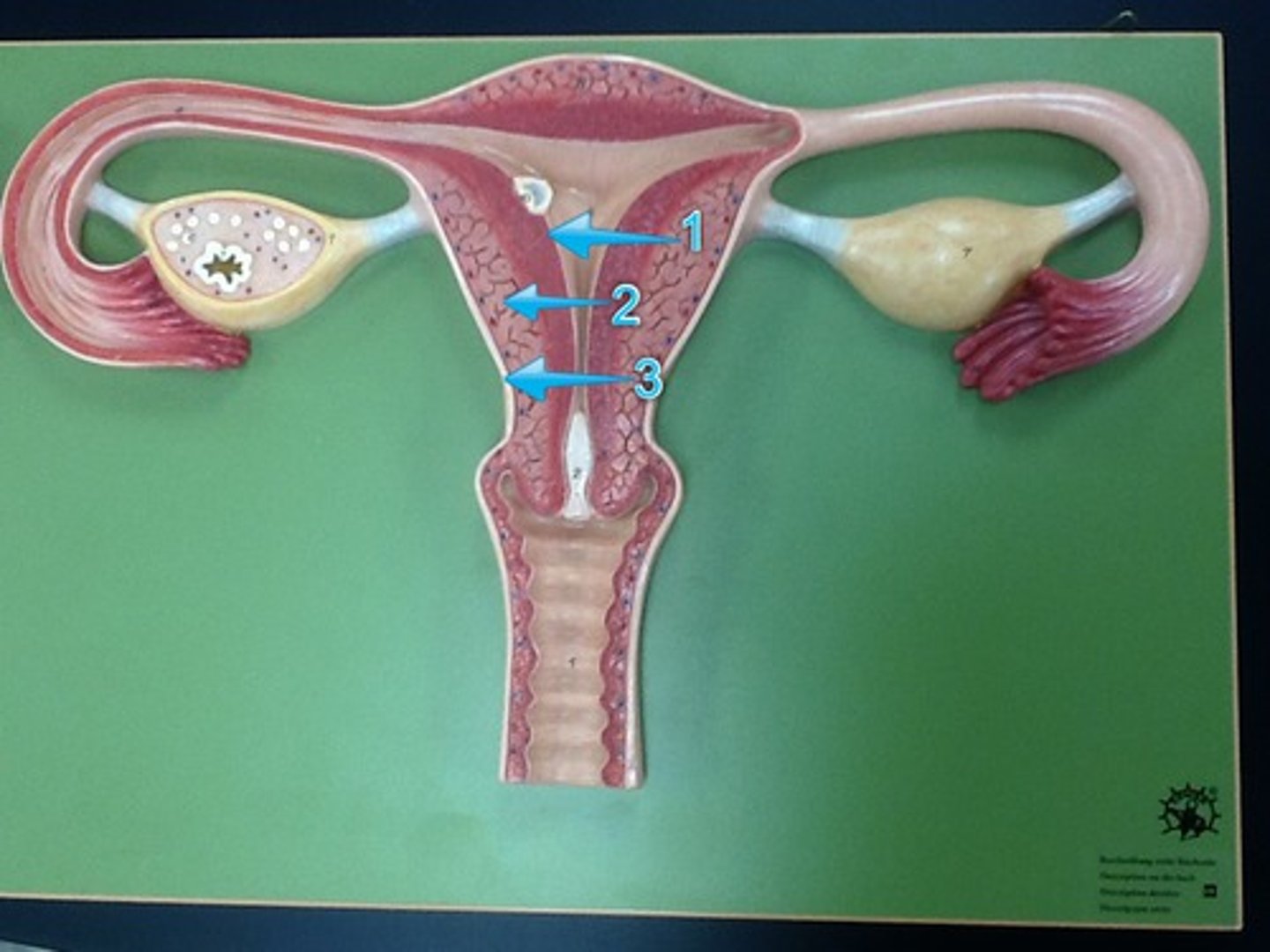 <p>inner mucosa</p><p>a. Simple columnar epithelium, compound tubular glands, and a stroma populated with leukocytes, macrophages, and other cells</p><p>-Stratum functionalis</p><p>-Stratum basalis</p><p>-During pregnancy, the endometrium is the site of attachment of the embryo and forms the maternal part of the placenta from which the fetus is nourished</p>