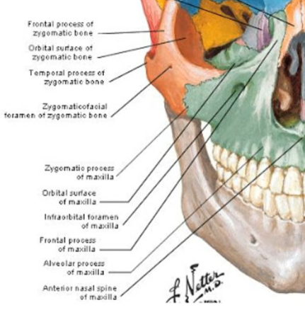 <p>zygomatic process maxilla, orbital surfrace maxilla, infraorbital foramen, frontal process, alveolar process, anterior nasal spine</p>