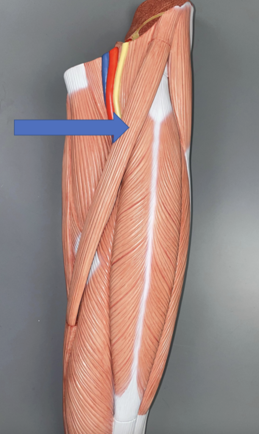 <p>muscle name &amp; action</p>