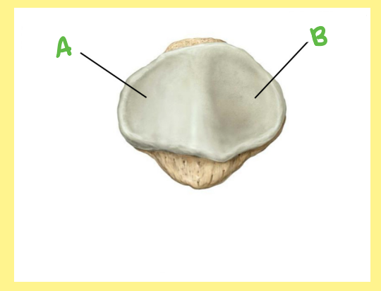 <p><u>Name the following</u>:</p><ul><li><p>Bone?</p></li><li><p>Side?</p></li><li><p>View?</p></li><li><p>A?</p></li></ul><p></p>