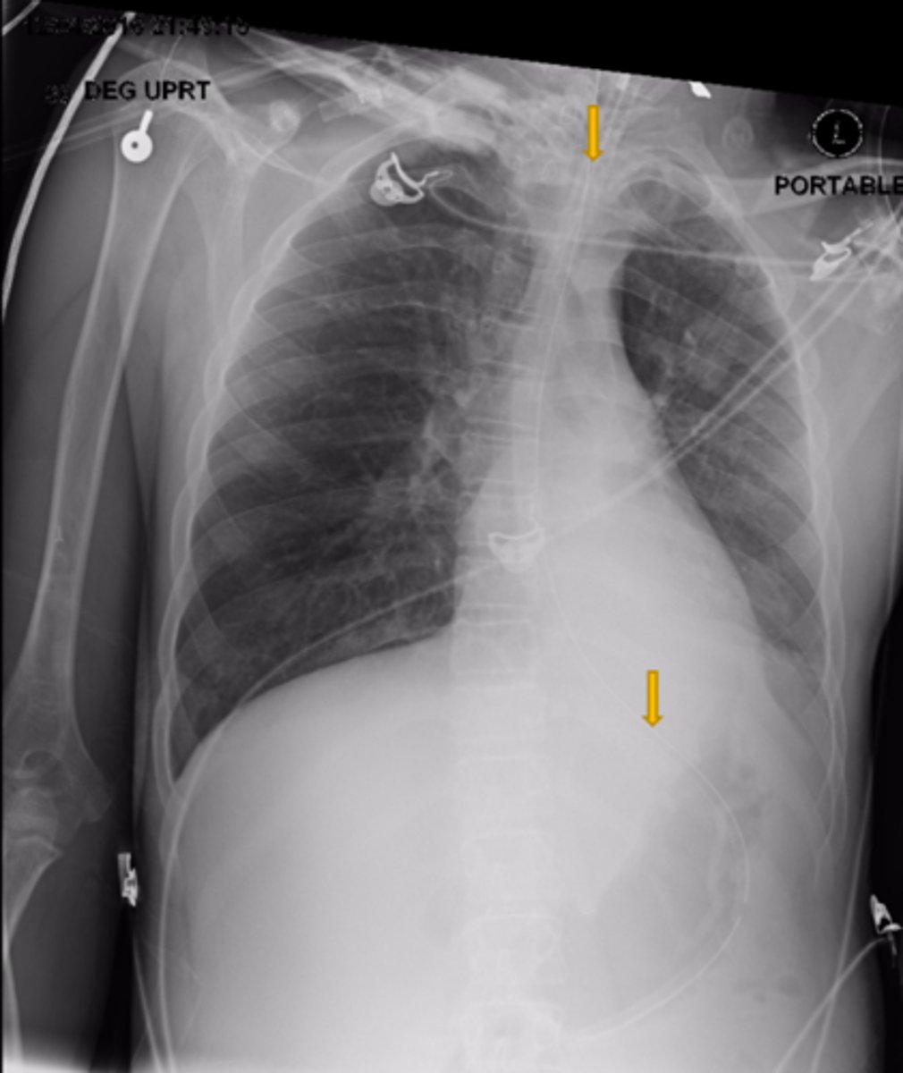 <p>What is the structure the yellow arrows are pointing at?</p>