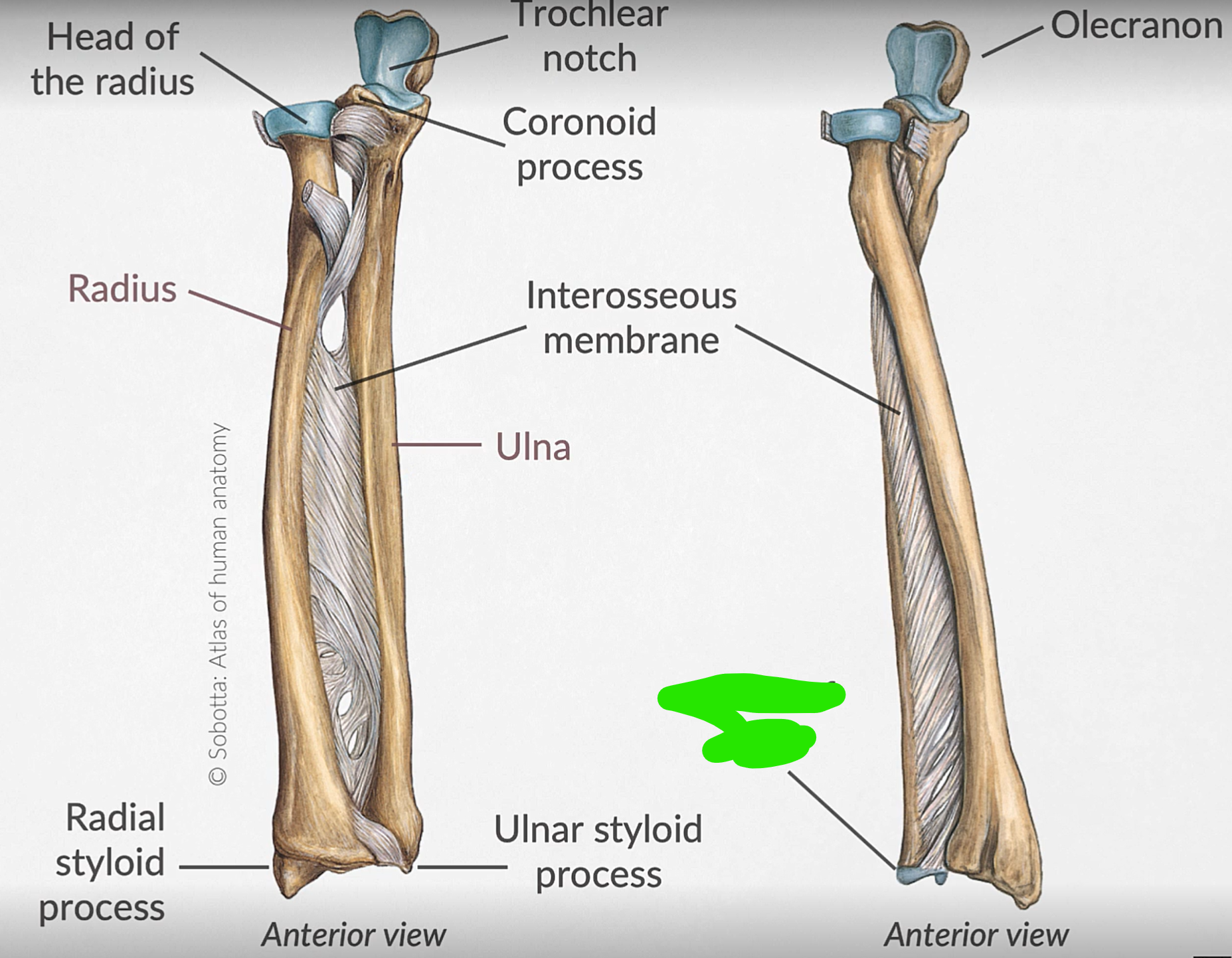 term image