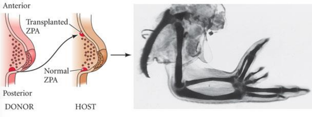 <p>distal limb duplication</p>