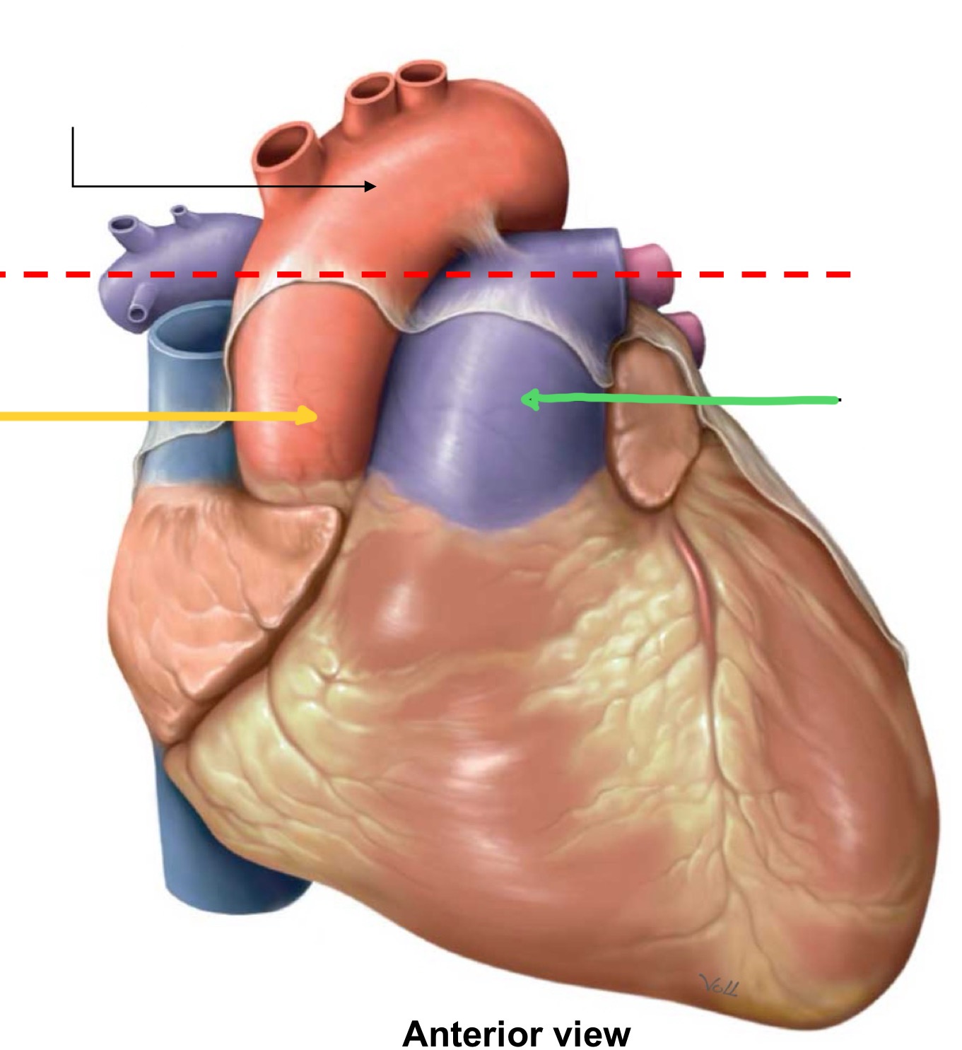 <p>What structure is identified by the black line?</p>