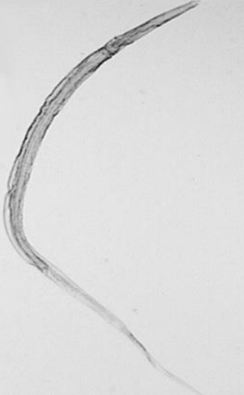 <ol><li><p><em><u>Probstmayria vivipara</u></em></p></li><li><p>Cecum (LI)</p></li><li><p>Horse</p></li><li><p>“Pinworm”</p></li><li><p>Female</p></li></ol><p></p>