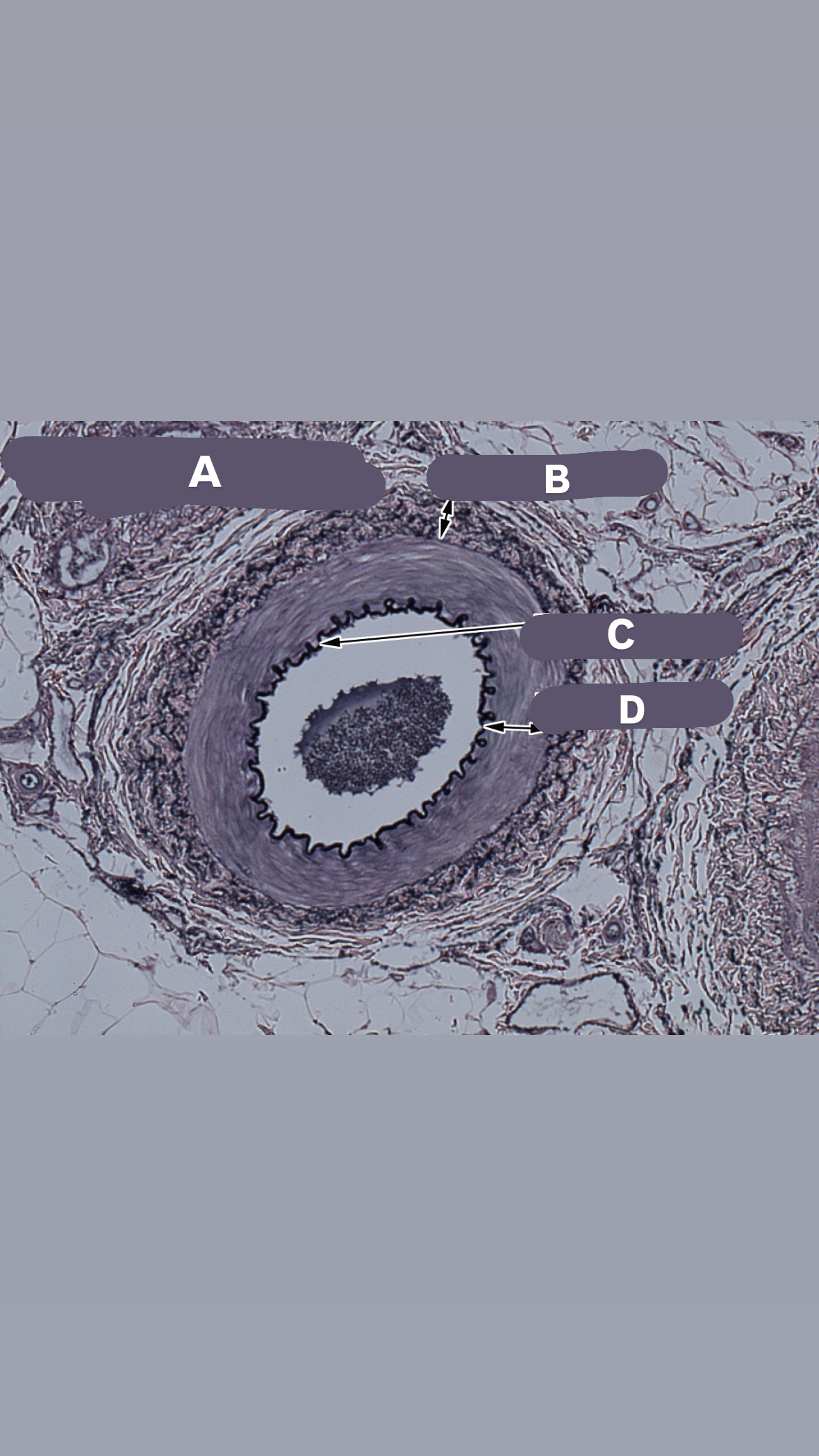 <p>what is c // internal elastic membrane- dark, wavy line</p>