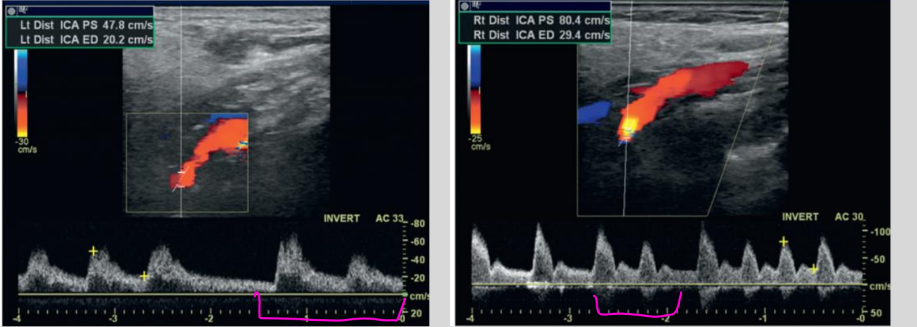 <p>what is this waveform showing?</p>