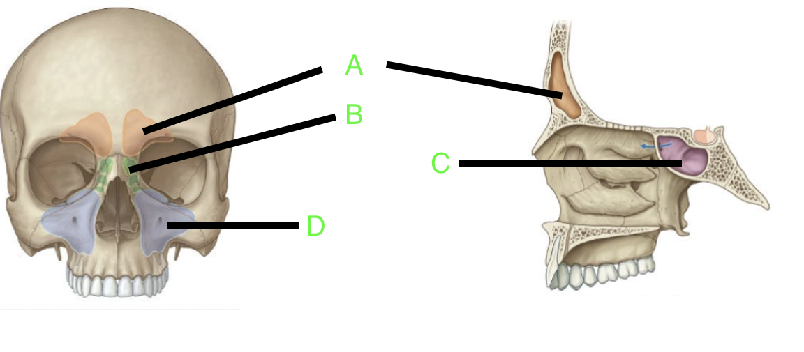 <p>A</p>