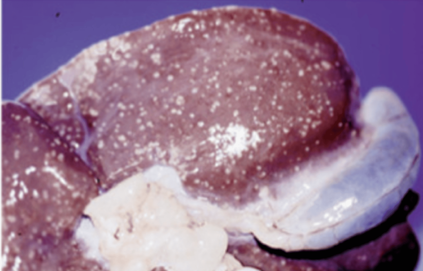 <p>lesiones granulomatosas diseminadas de forma miliar en la superficie corporal y el hígado</p><p>L. monocytogenes: meningoencefalitis</p>