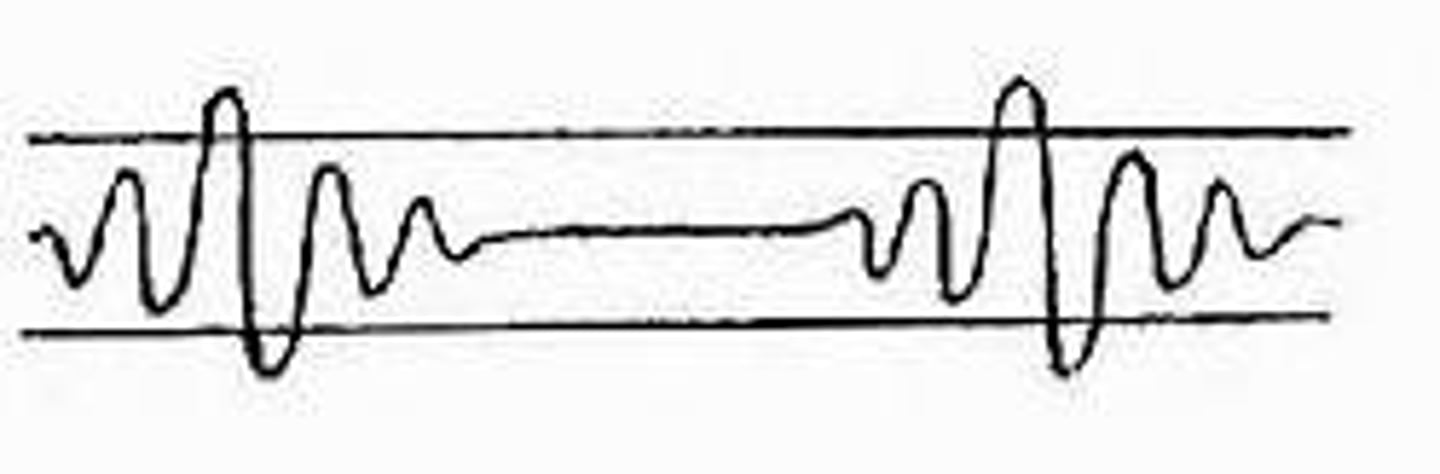 <p>a distinct pattern of breathing characterized by quickening and deepening respirations followed by a period of apnea</p><p></p><p>causes: CHF, renal failure, increased intracranial pressure, dying patient </p>