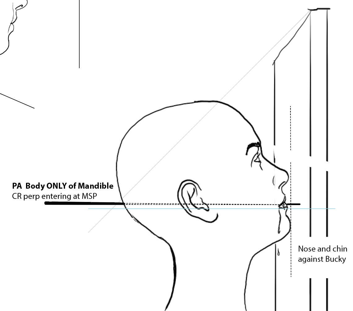 <p>nose and chin on bucky, perp CR exits lips</p>