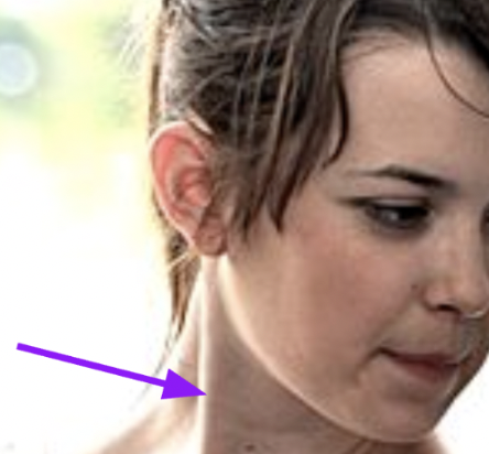 <p><span style="font-family: "Times New Roman", serif"><strong>Which muscle allows her to turn her neck?</strong></span></p>