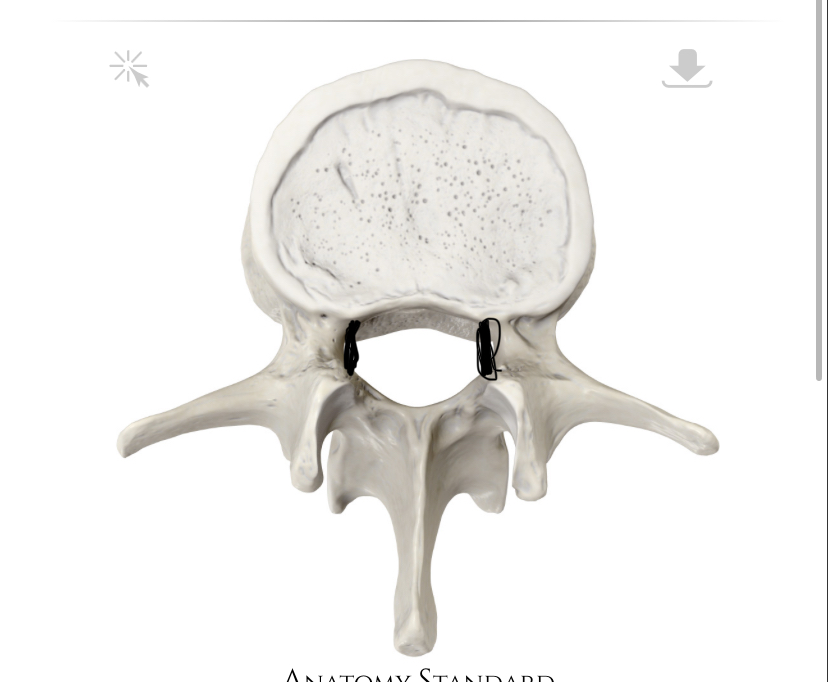 <p>Hoe heet dit deel?</p>