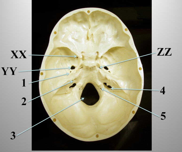 <p>What structure is number 1?</p>
