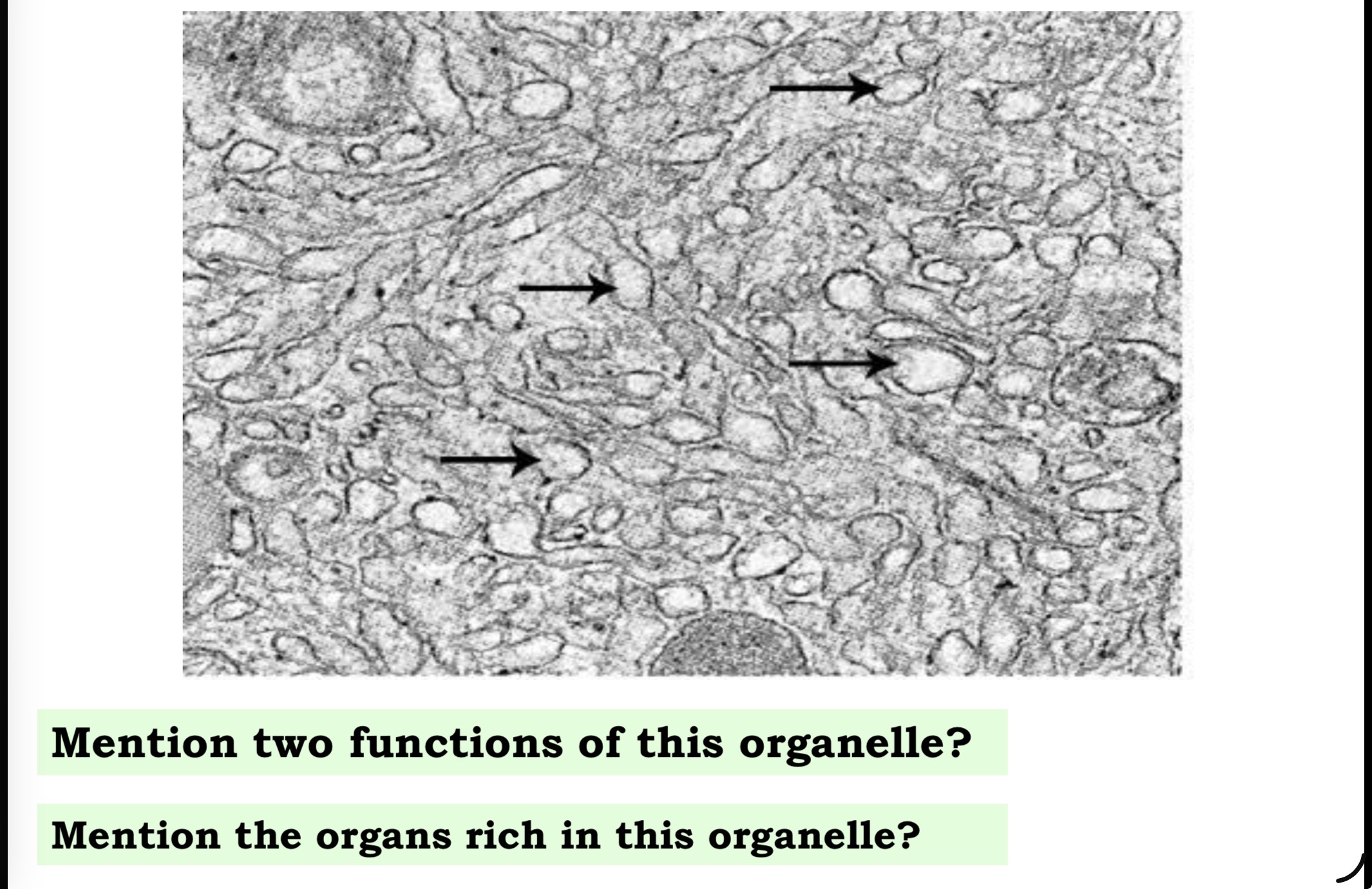 <p>Answer the questions in these following pictures</p>