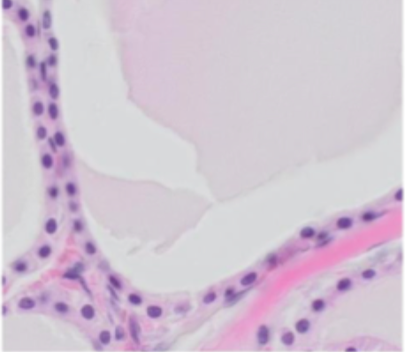 <p>Angiv epitheltypen (Thyroidea)</p>