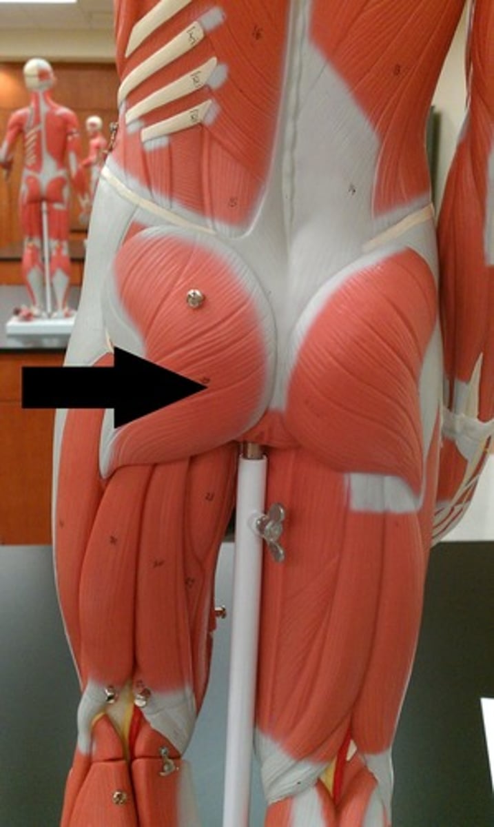 <p>Proximal attachment: Iliac crest, sacrum, and coccyx</p><p>Distal attachment: IT band and femur</p><p>Comments, Applications and Relationships: Largest of gluteal muscles, also laterally rotates the thigh. Helpful hint- the hamstring muscles, (semimembranosus, semitendinosus, and biceps femoris) aid in the extension of the thigh.</p><p>Action: Extensor of the thigh at the hip.</p>