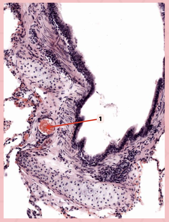 <p>Identify the structure labeled as 1.</p>