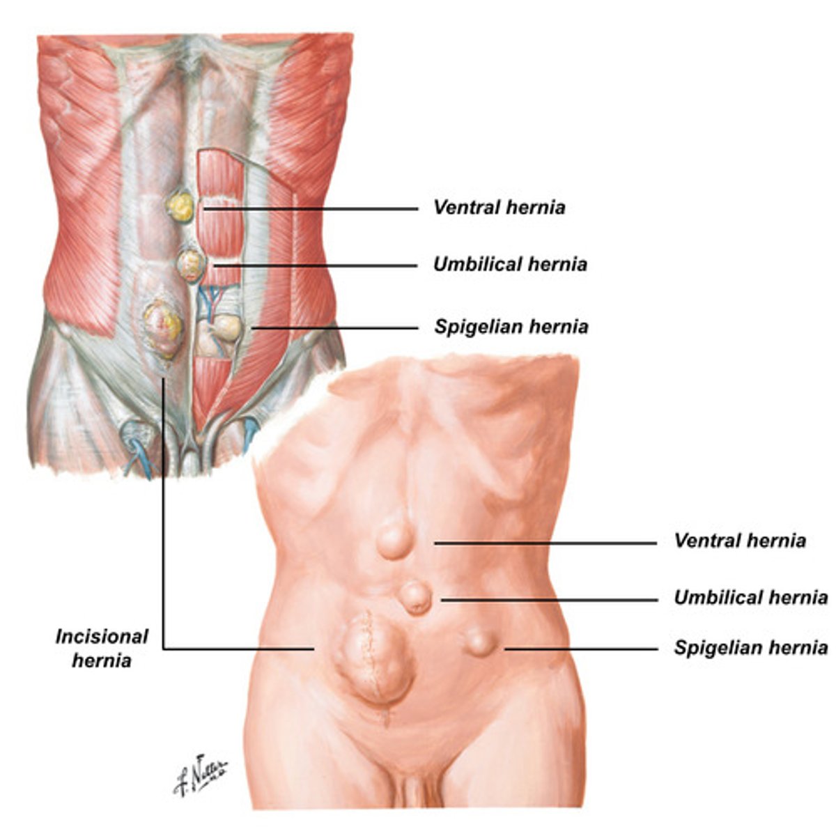 <p>Spigelian</p>