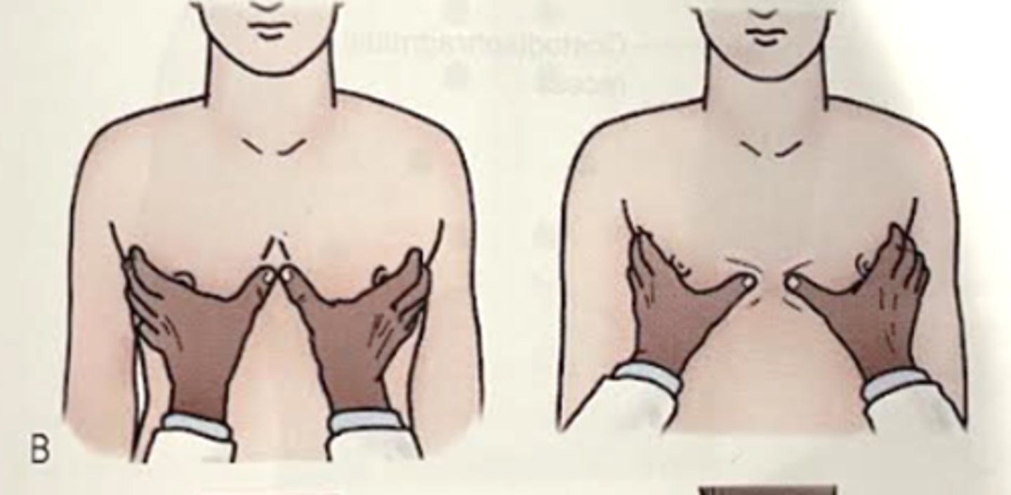 <p>-Placing fingers laterally and over the posterior axillary folds. Palms pressed firmly on the anterior chest wall. Skin in drawn medially until thumbs meet at the midline. Patient to take a maximal inspiration and therapist's hands should glide with the movement of the lobes underneath<br><br>-Noting: symmetry and extent of movement</p>