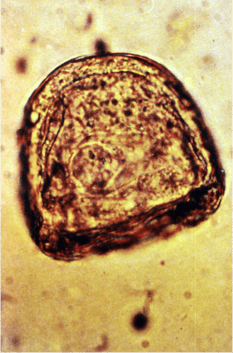 <p>equine tapeworm</p>