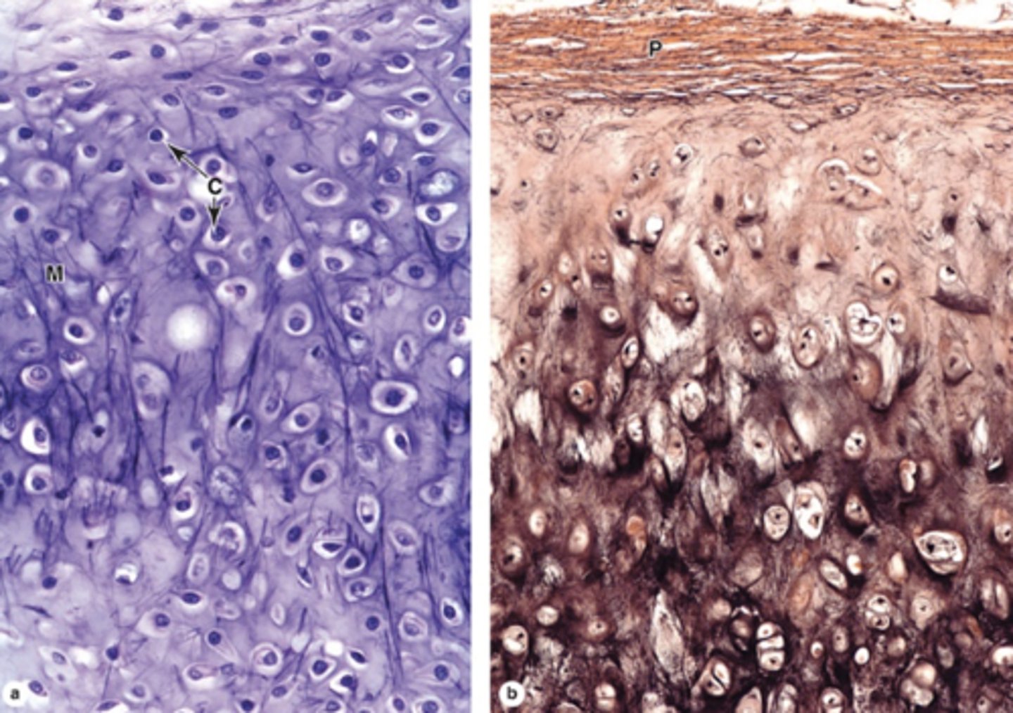 <p>What is a key functional property of elastic cartilage?</p>