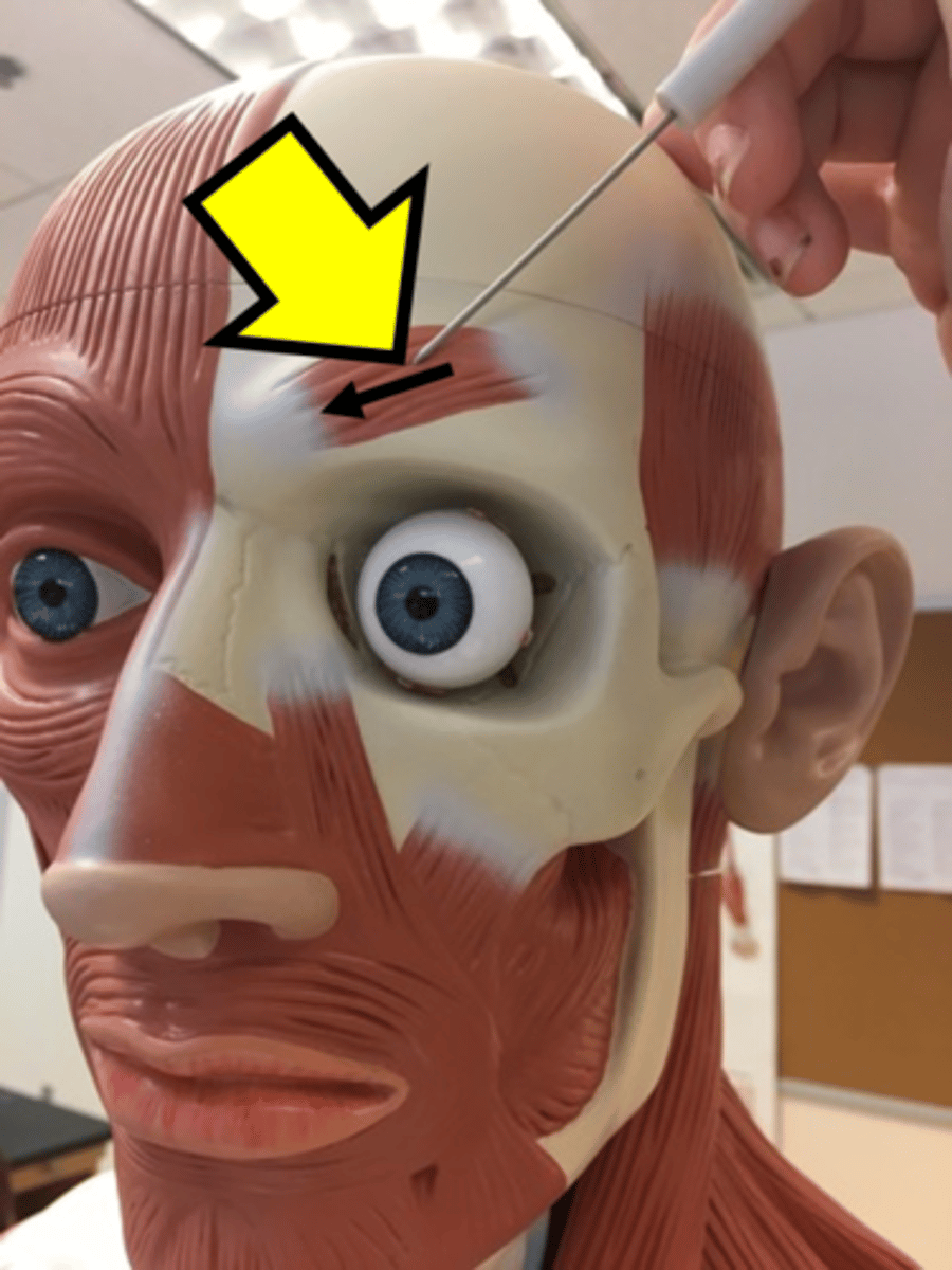 <p>Name the muscle</p>