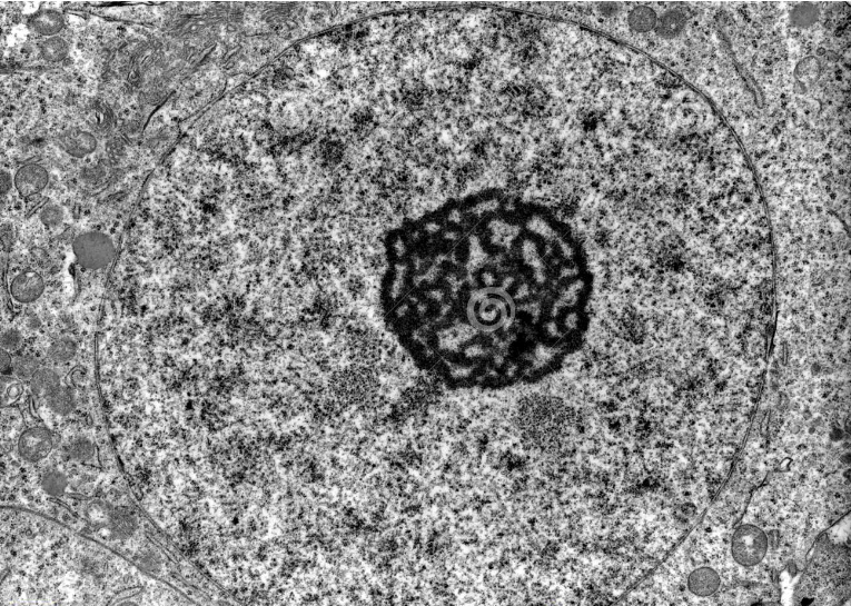 What kind of microscope was used to capture this electron micrograph of a nucleus?