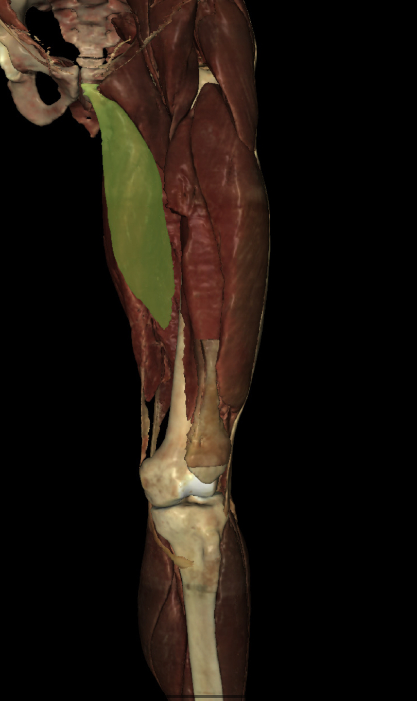 <p>Identify the Structure</p>