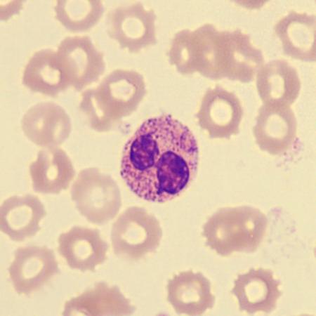 <p>What characteristics is this neutrophil showing?</p>
