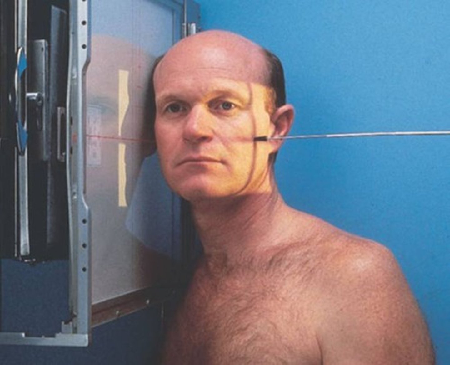 <p>What is this projection?</p><p>How is Patient positing?</p><p>What is the CR?</p><p>What are the structures shown?</p>