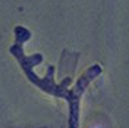 <p>what type of hyphae is this</p>