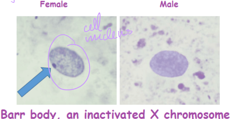 <p>Inactivated X chromosome in female mammals that appears dark because it is still in condensed chromosome form</p>