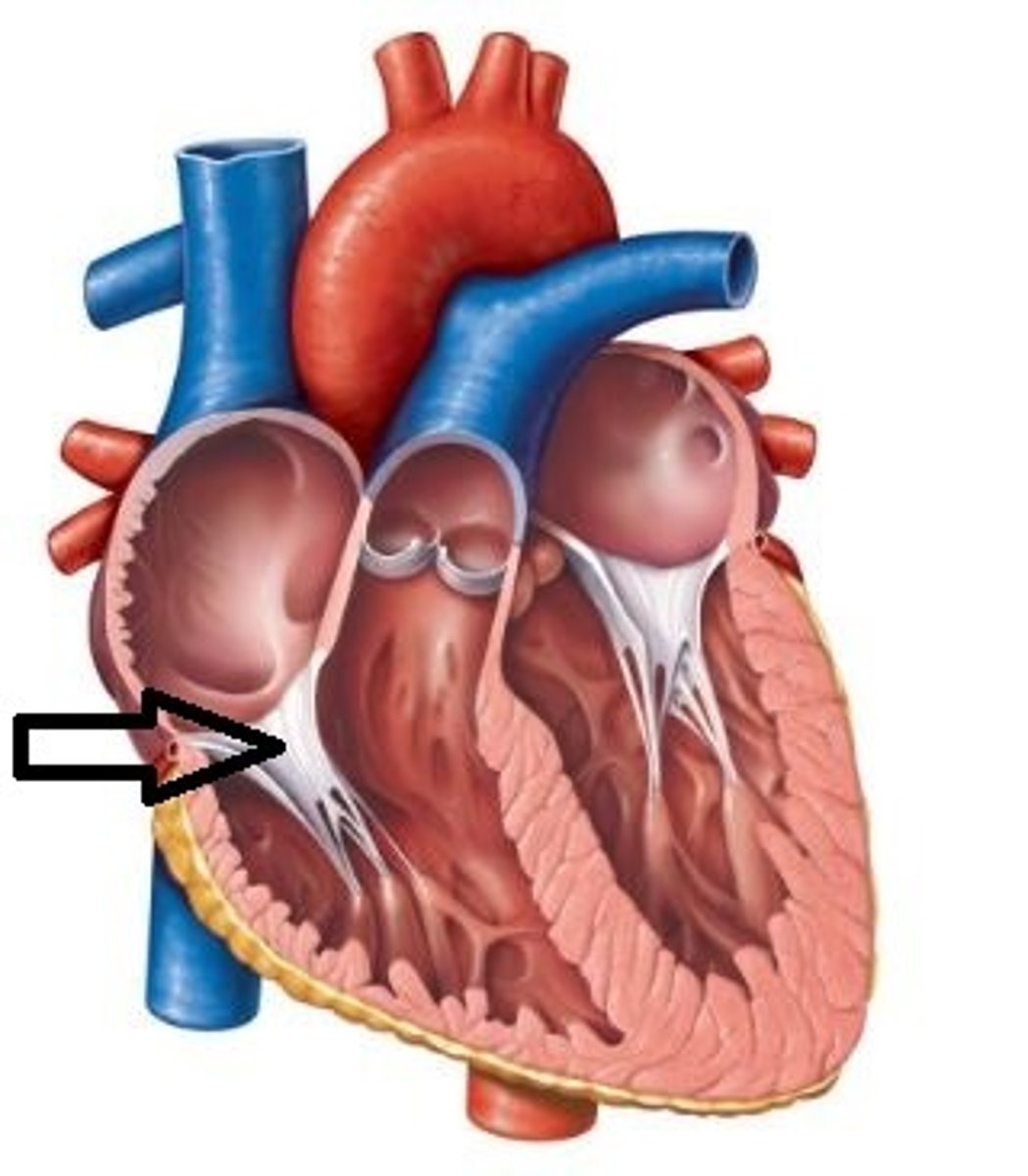 <p>Located between the R atrium and R ventricle</p>