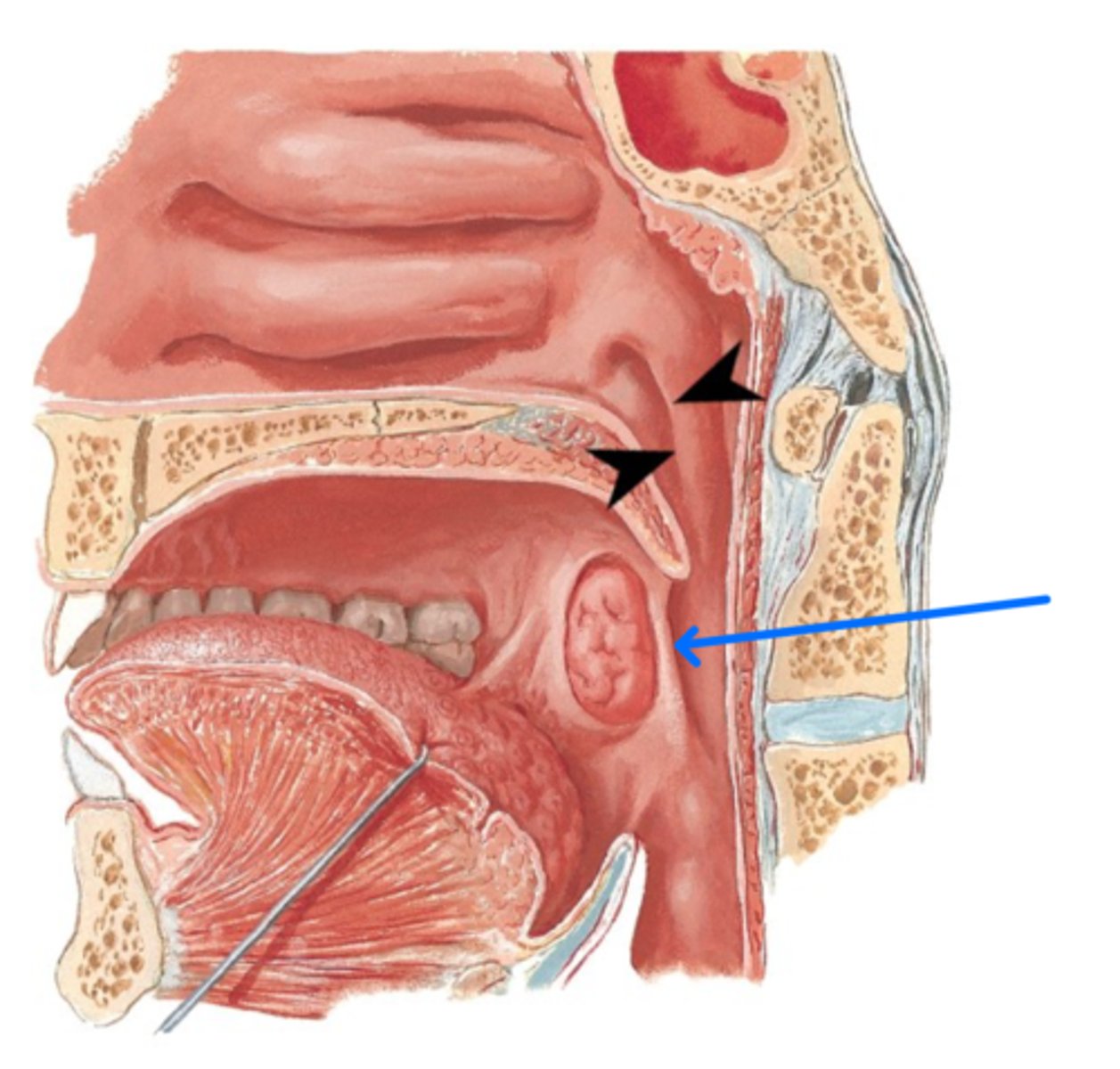 <p>What is the blue arrow pointing to?</p>