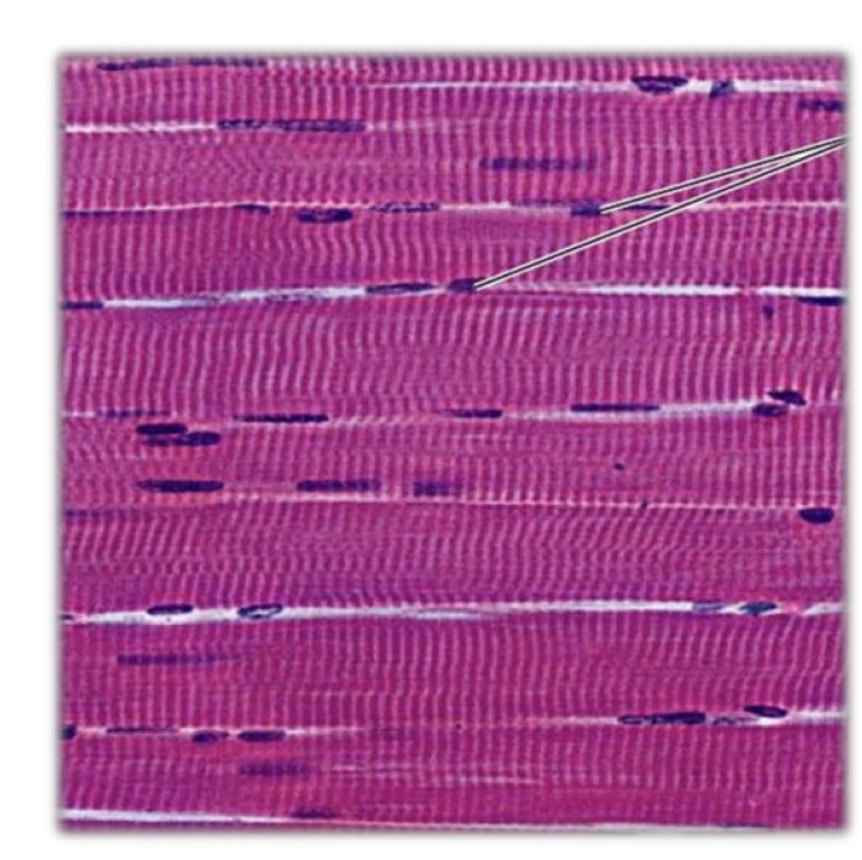 <p>At the periphery, just beneath the sarcolemma.</p>