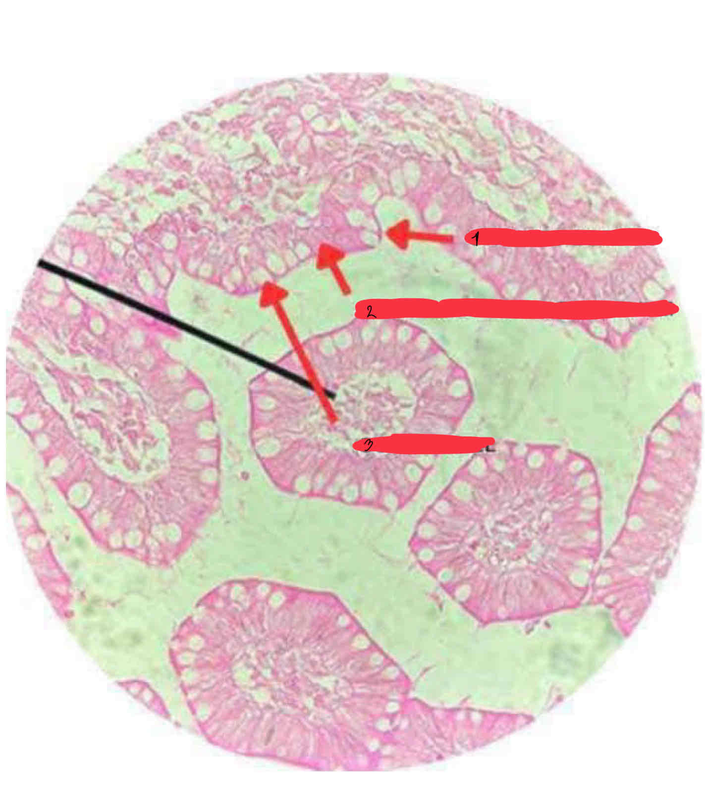 <p>Ileum</p>