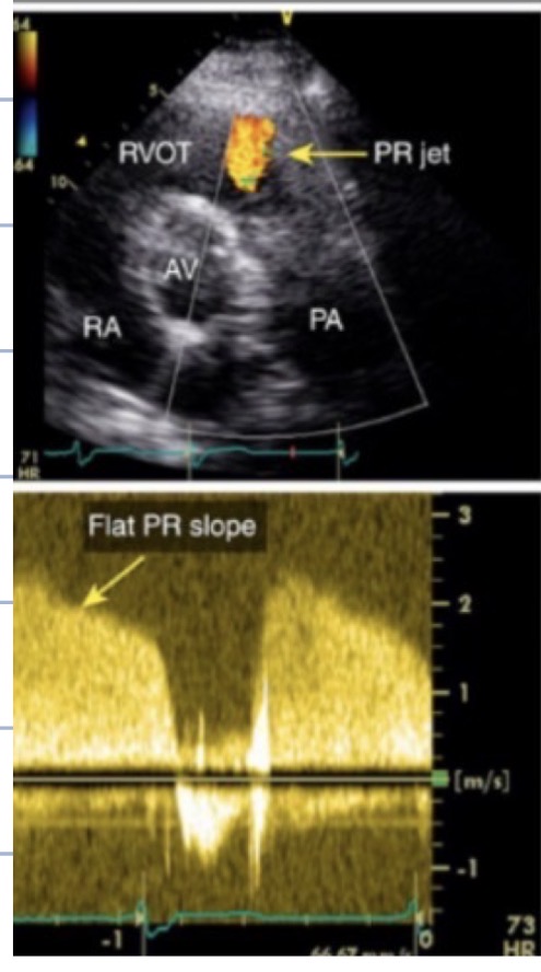 <p>What grade of PR is this</p>