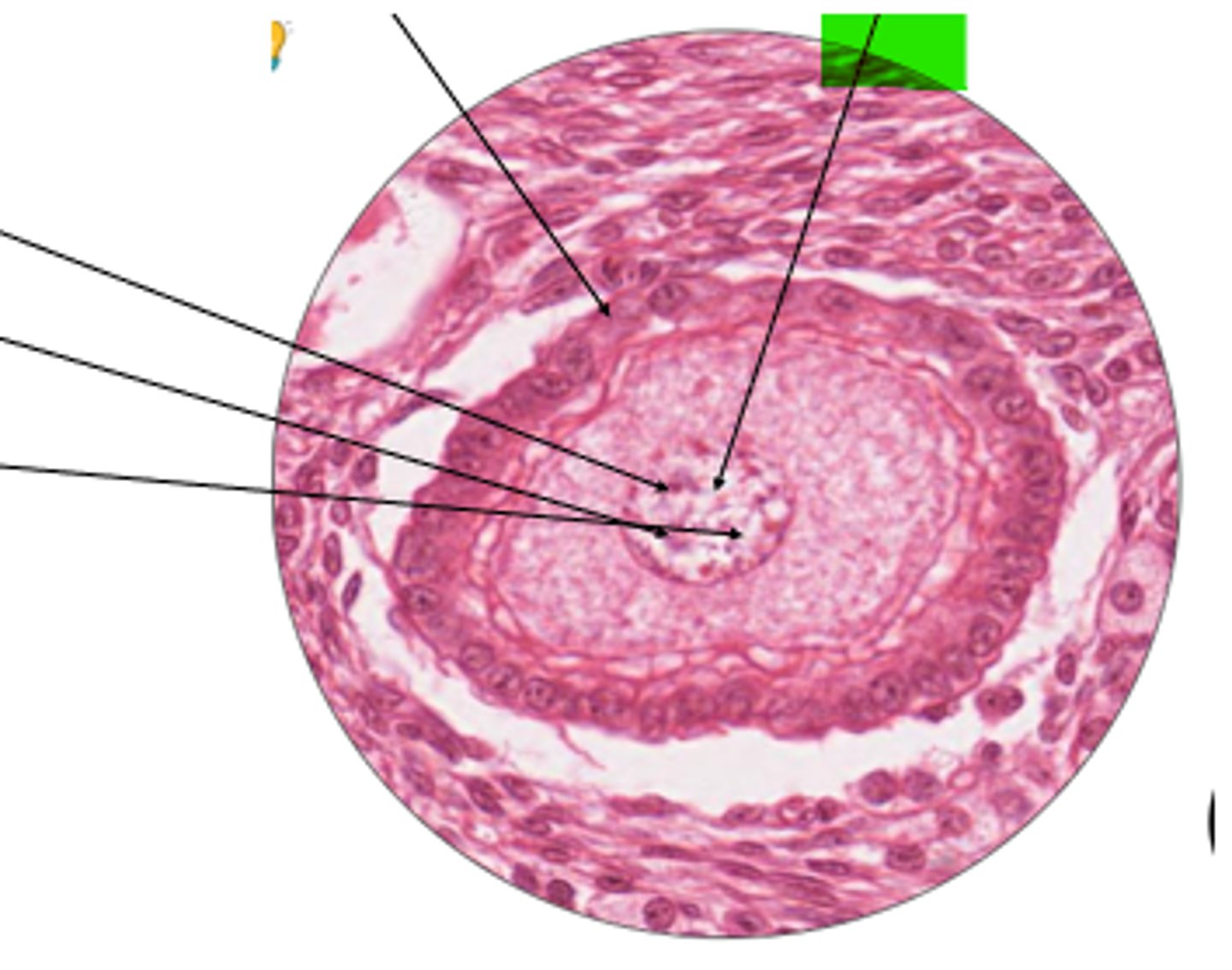 <p>part of tertiary follicle?</p>