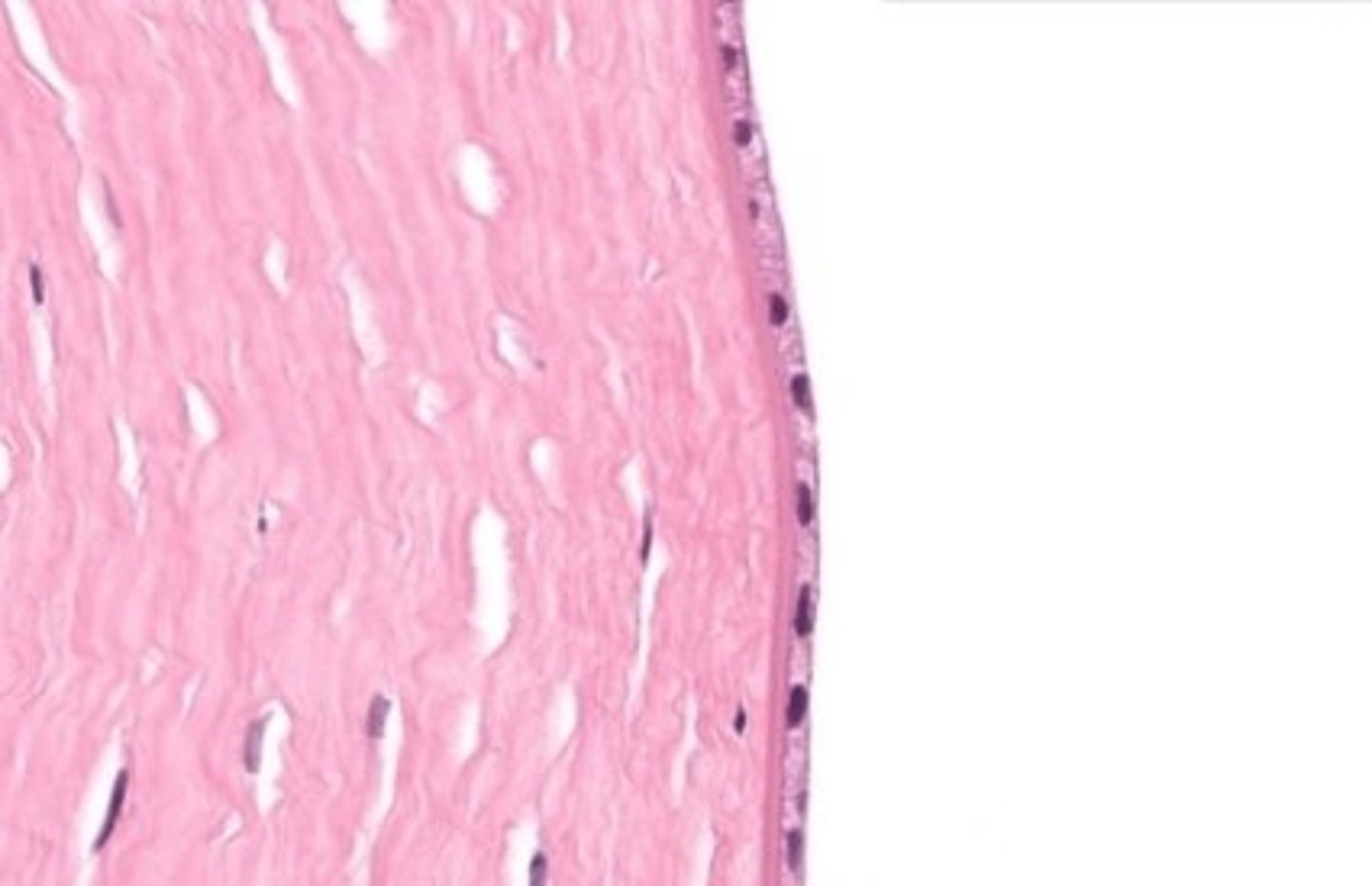 <p>posterior surface of the cornea</p>