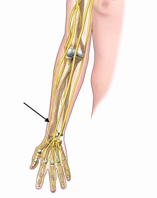 <p>Radial nerve</p>
