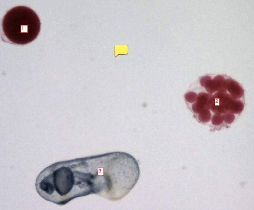<p>starfish development stages- (2)</p>