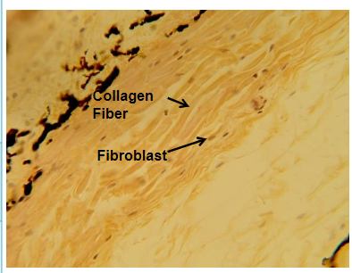 <p>irregular/random arrangement of fibers densley packed in multiple directions</p><p>location: mostly dermis of skin, capsules around organs and joints</p><p>function: strong in all directions</p>