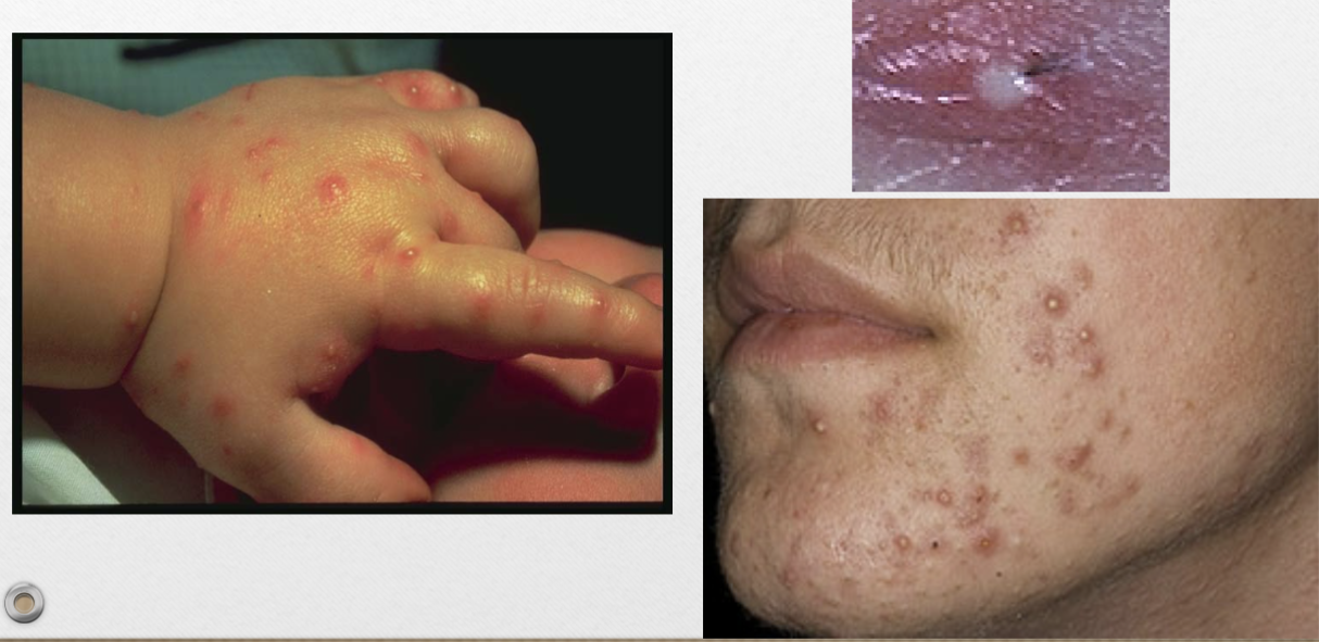 <p>ex. acne, clogged pores</p>