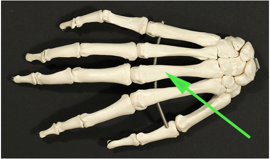 <p>Name the bone found in the palm of the hand that is indicated by the green arrow.</p>