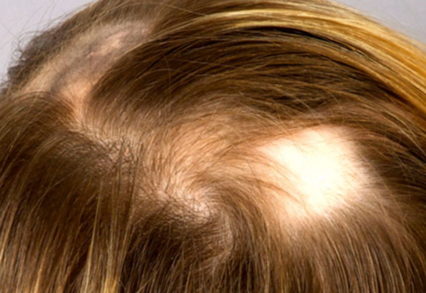 <p>What is the diagnosis?</p>