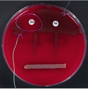 <ul><li><p>alpha hemolysis (green)</p></li><li><p>non-lancefield</p></li><li><p>optochin sensitivity</p></li></ul><p></p>