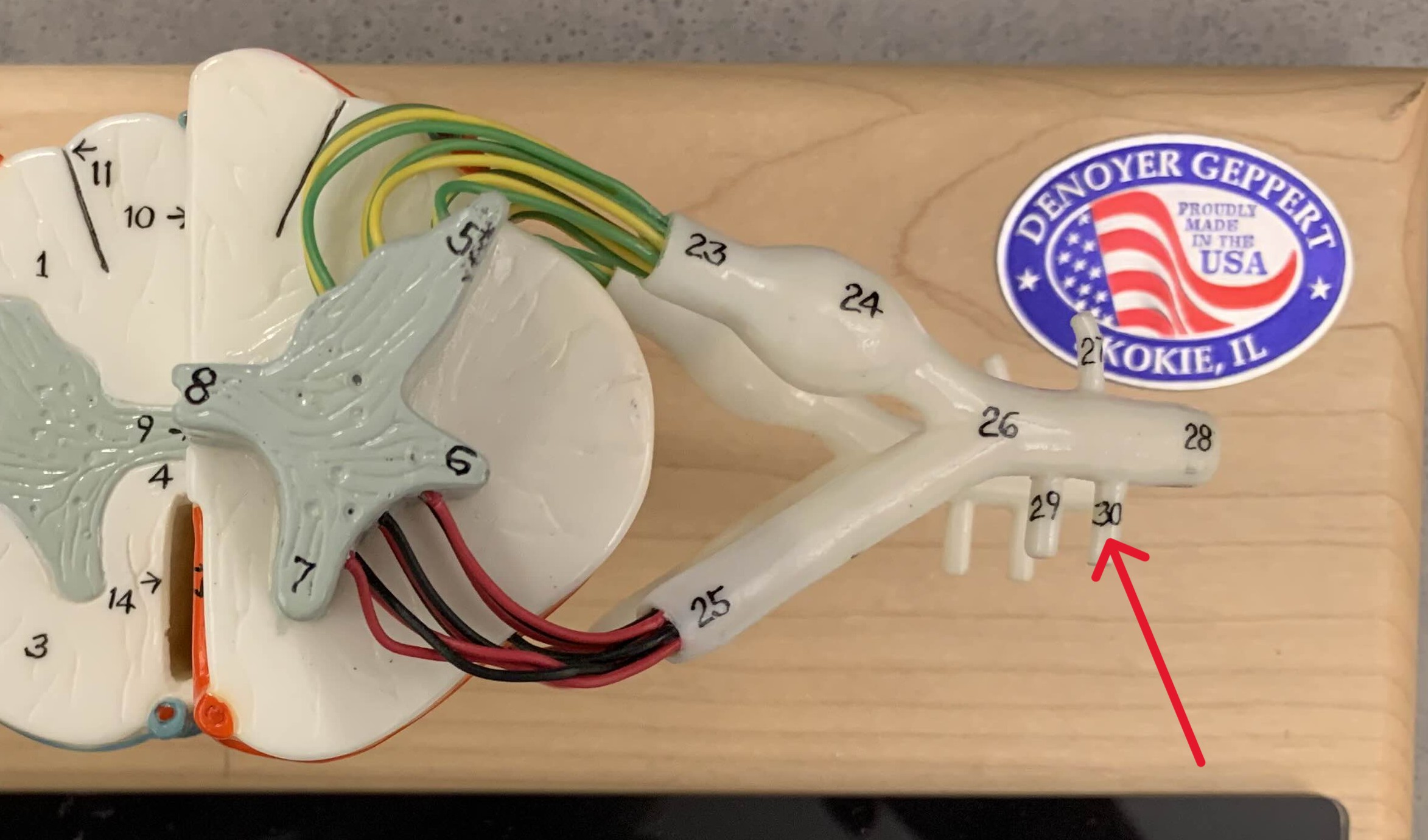 <p>Which ramus of the spinal cord is:</p><ul><li><p>Slightly lateral to the gray ramus</p></li><li><p>Attached to ventral ramus</p></li></ul><p></p>