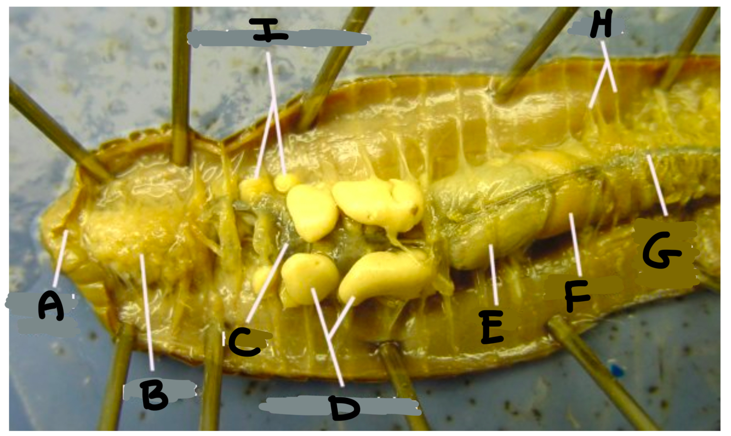 <p>What part of the earthworm is labeled A</p>