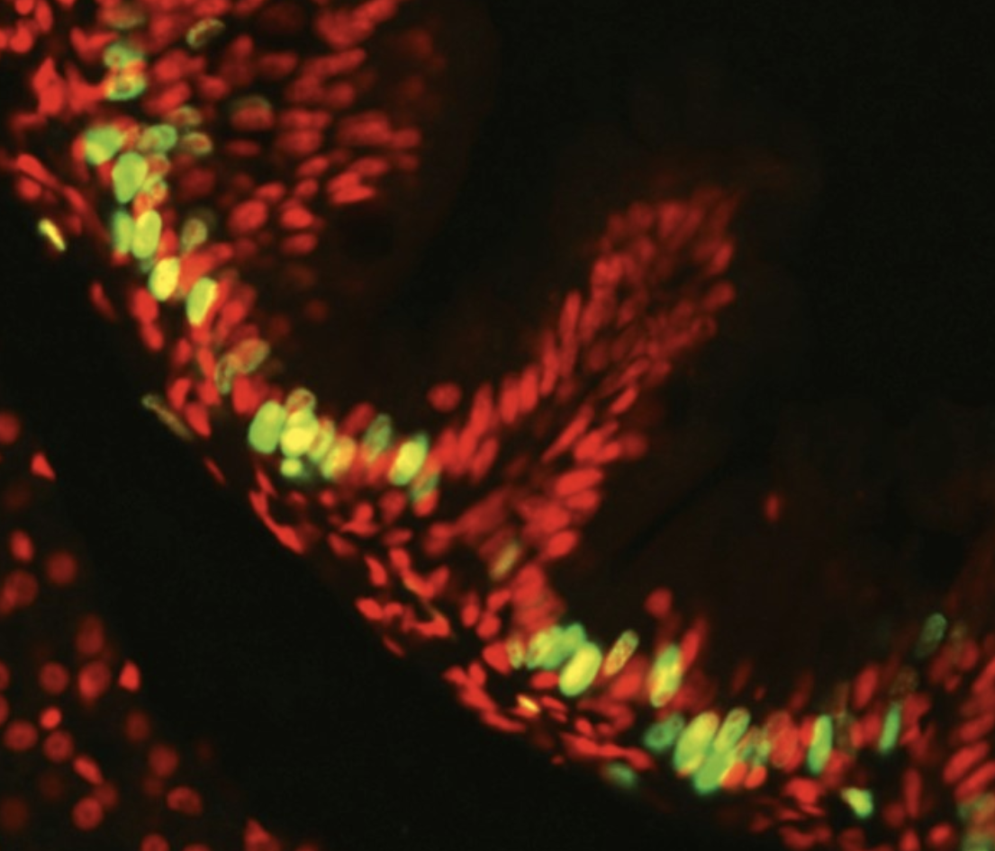 Describe the green fluorescent cells in this image?